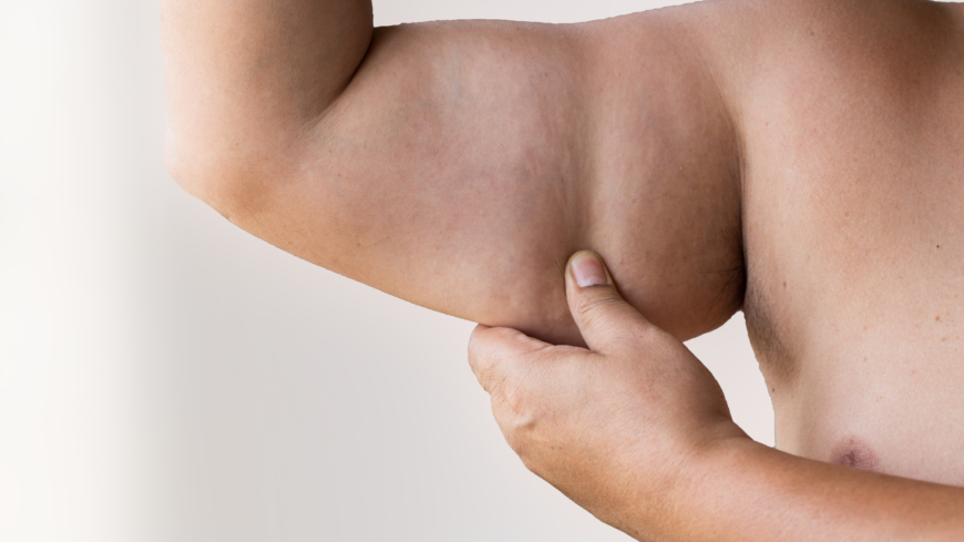 Var tredje barn i Europa lider av övervikt eller fetma